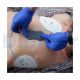 Desfibrilador Desa - Manual Reanibex 500 Ems